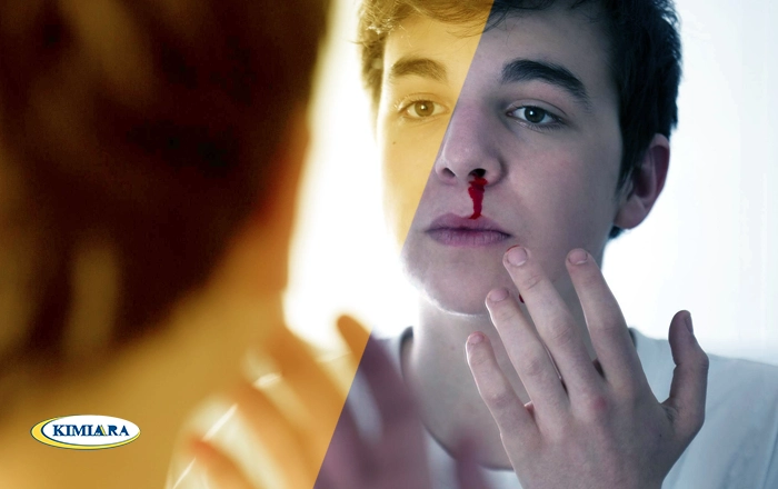 خون دماغ نشانه‌ کدام بیماری‌ است؟