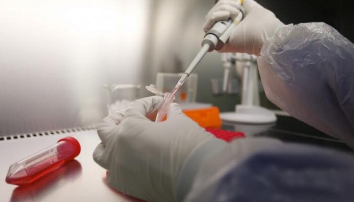 آورده اقتصادی پلاسما چقدر است؟