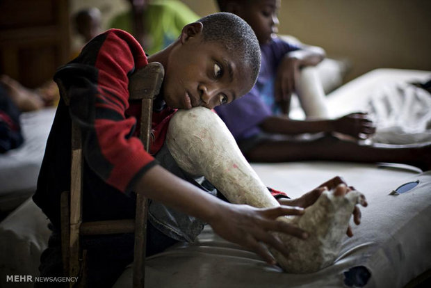 سازمان جهانی بهداشت پایان شیوع فلج اطفال در ماداگاسکار را تأیید کرد